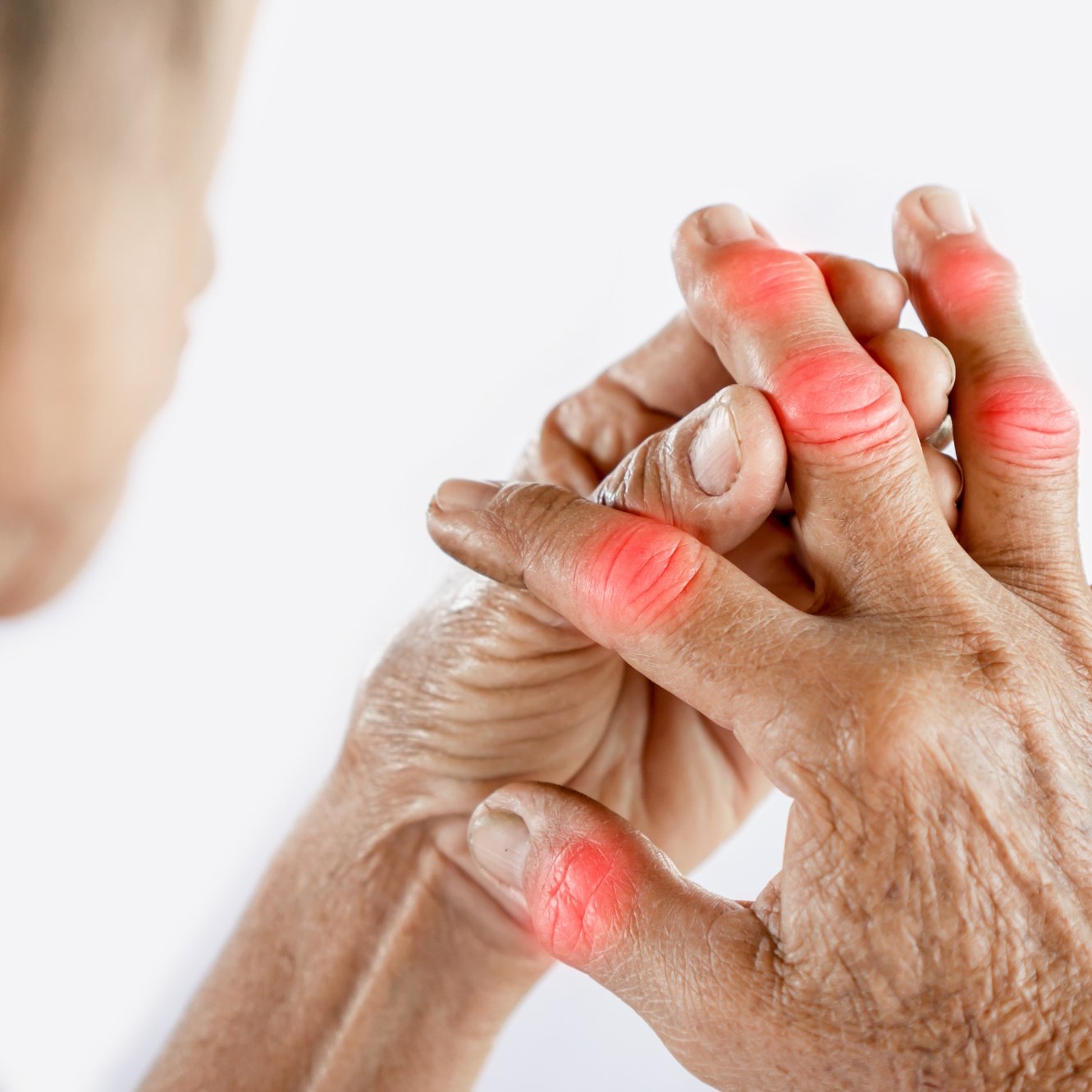 Helps in swelling, arthritis, joint-pains