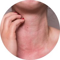 Supports Healthy Skin