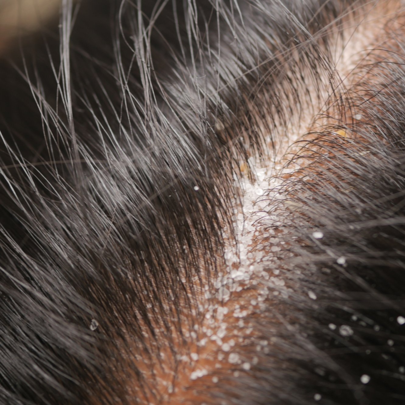 Nourishes Scalp, Dandruff Control