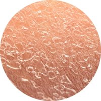 Supports the Skin’s Natural Moisture Barrier