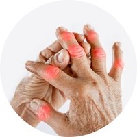 Supports Joint Comfort & Mobility